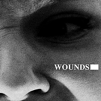 Wounds