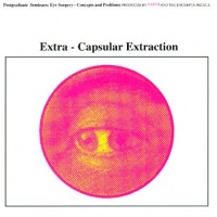 Extra-Capsular Extraction